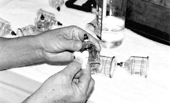 Cupping_set_Therapy_04